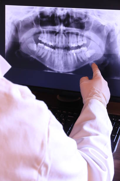 Best Holiday Emergency Dentist in Quincy, CA