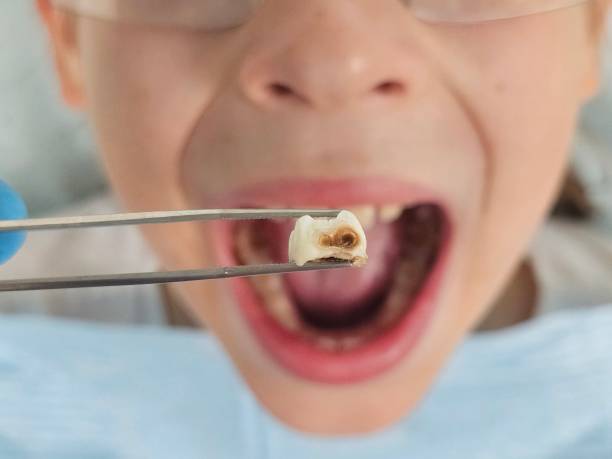 Best Orthodontic Emergency Dentist in Quincy, CA