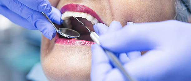 Best Emergency Dental Care for Abscessed Tooth in Quincy, CA